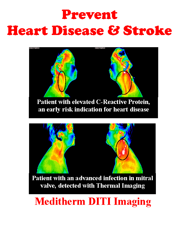 4 Prevent Heart Disease wgt