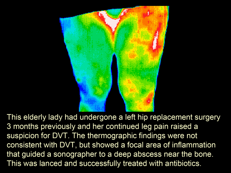 Full Body Imaging » Medical Thermography